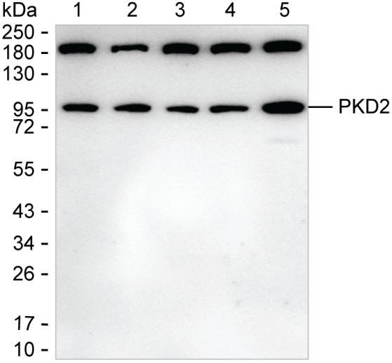 PKD2